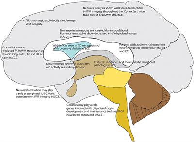 Confused Connections? Targeting White Matter to Address Treatment Resistant Schizophrenia